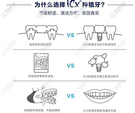 為什么會(huì)選擇做ICX種植系統(tǒng)