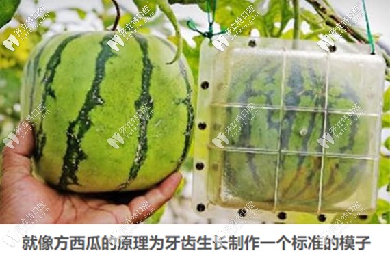 兒童早期牙齒矯正器矯正的原理圖