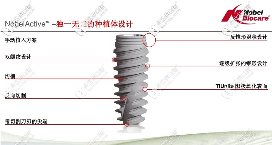nobelactive種植體的優(yōu)勢