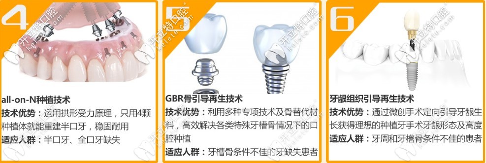all-on-N種植技術(shù)和上頜竇提升術(shù)優(yōu)勢