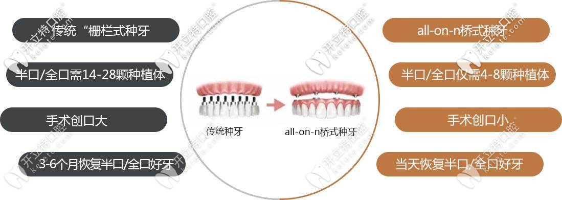 傳統(tǒng)種植呀和all-on6區(qū)別