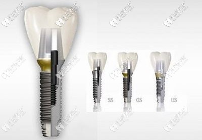 3i種植系統(tǒng)規(guī)格一覽表