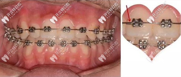 濰坊市傳統(tǒng)金屬矯正5999元起