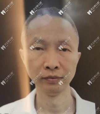 <!--<i data=20240703-sp></i>-->悅康口腔黃勝春醫(yī)生