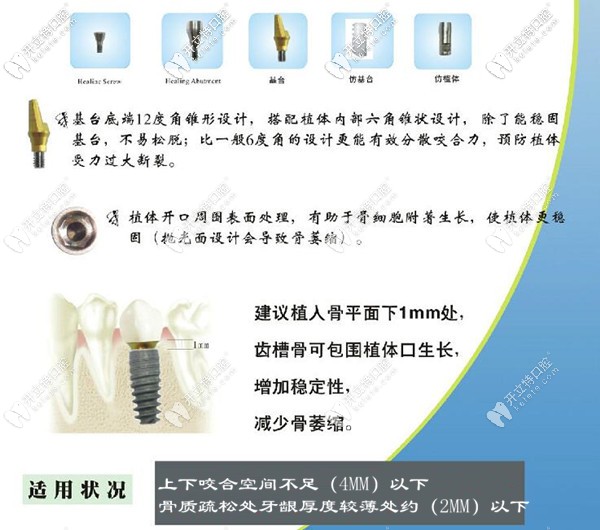 美國歐妮泰種植牙品牌適應癥