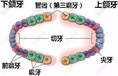 低位阻生智齒一定要拔嗎?和高位的那點區(qū)別儂要注意喲