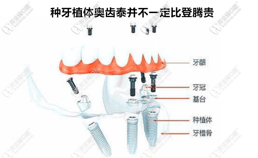 奧齒泰并不一定比登騰貴