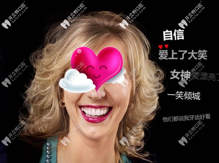 經(jīng)過(guò)DSD微笑設(shè)計(jì)后做的瓷貼面后