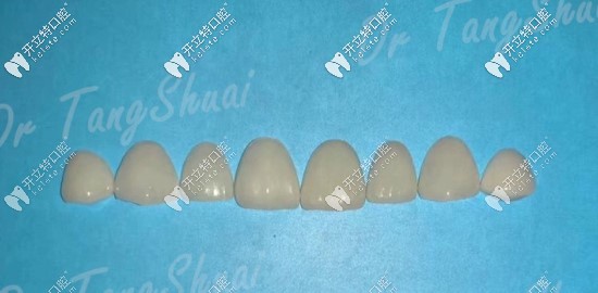 牙貼面照片圖