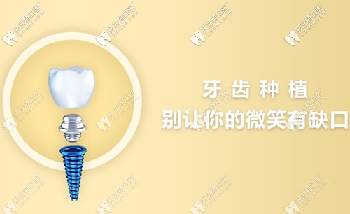 <!--<i data=20240703-sp></i>-->民尤其擅于微創(chuàng)種植手術