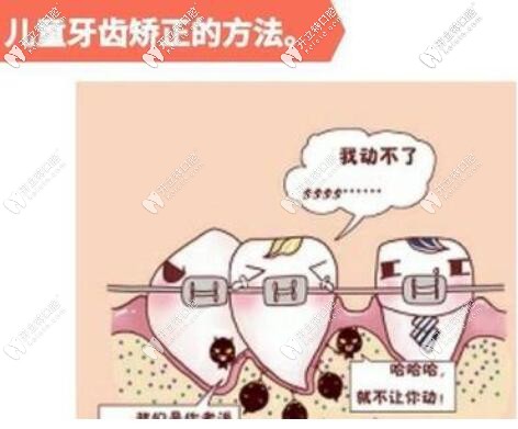 兒童早期矯正器分類