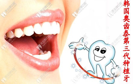 韓國(guó)奧齒泰種植牙價(jià)格