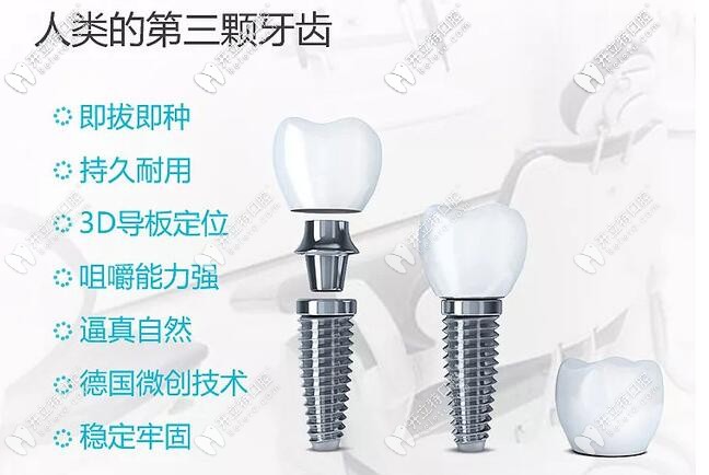 德國ht種植體優(yōu)勢