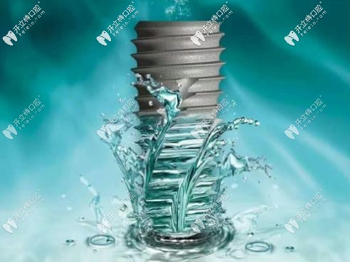 伊諾種植體外觀