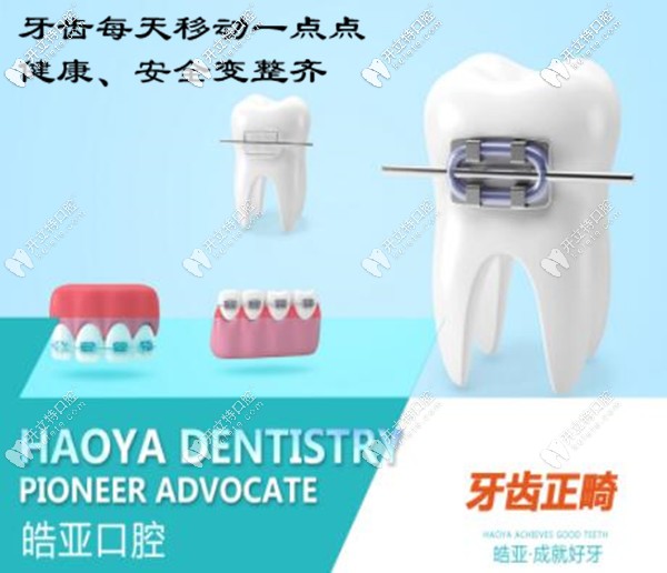 蘭州皓亞口腔牙齒矯正價(jià)格