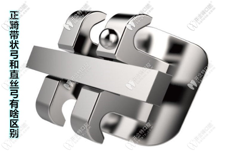 牙齒深覆合矯正用帶狀弓矯治器和直絲弓矯正各有啥優(yōu)缺點