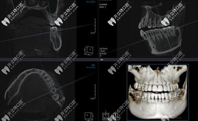 數(shù)字化影像三維重建