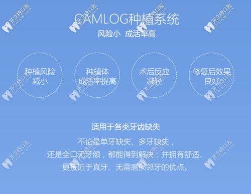 camlog種植體優(yōu)點(diǎn)
