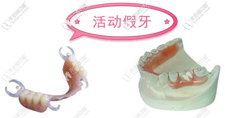 福州牙科鑲假牙收費價目表