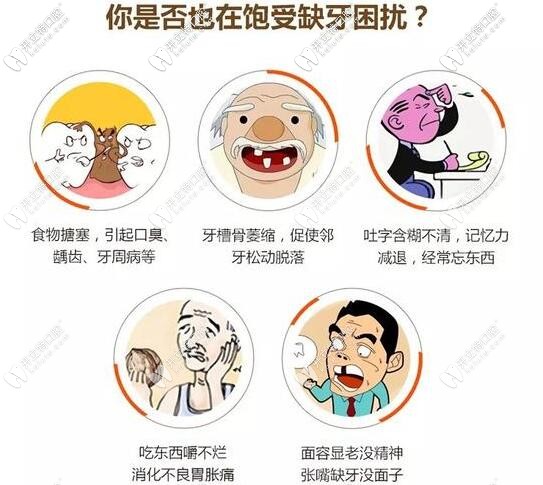 要問(wèn)福州鑲牙多少錢(qián)?秘密都在這假牙材料的種類(lèi)和價(jià)格里