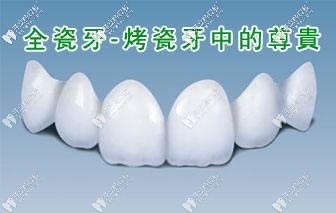 你知道國(guó)產(chǎn)品牌愛(ài)迪特全瓷牙的價(jià)格和材質(zhì)是啥子嘛