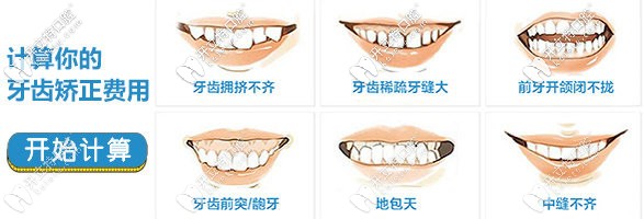 牙齒矯正的價格
