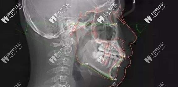 口腔影像AI分析評估系統(tǒng)