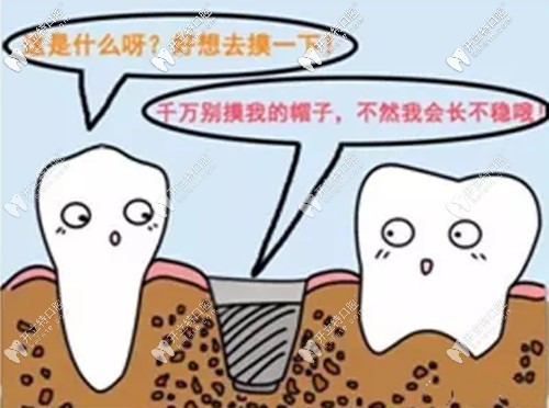 張少軍院長講解種植牙術(shù)后的一些常見注意事項