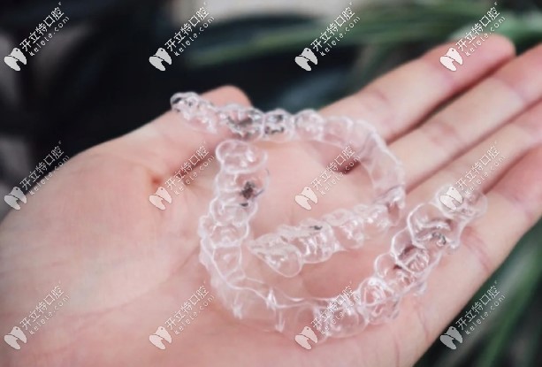 smilelab牙齒矯正靠譜嗎?戴笑盈隱形牙套整牙后來(lái)說(shuō)說(shuō)效果