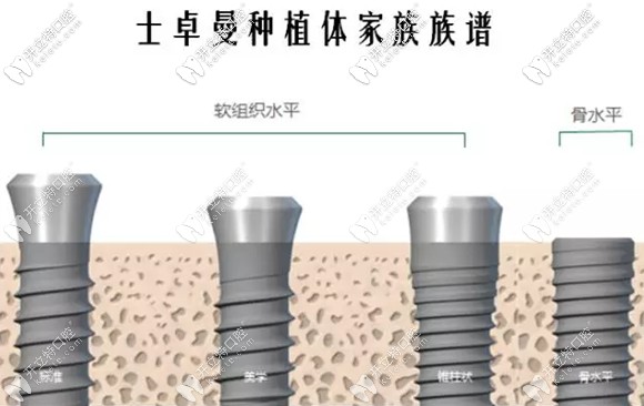 種植界的大神-瑞士士卓曼(ITI)種植牙多少錢(qián)一顆,你想知道嗎