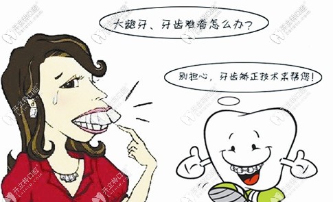 通過(guò)矯正來(lái)改善門(mén)牙外凸