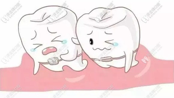 什么情況適合半口矯正呢？