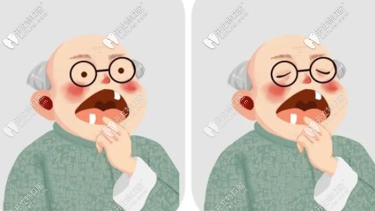 老爸在福州做登騰全口種植牙花了10多萬(wàn),誰(shuí)來(lái)評(píng)價(jià)下效果