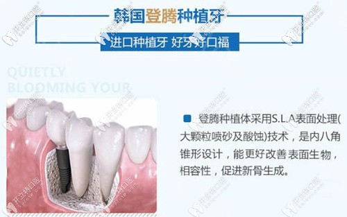 福州維樂(lè)口腔韓國(guó)登騰種植牙