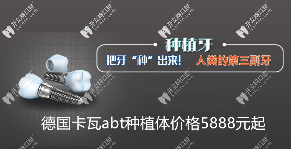 德國卡瓦abt種植牙價格