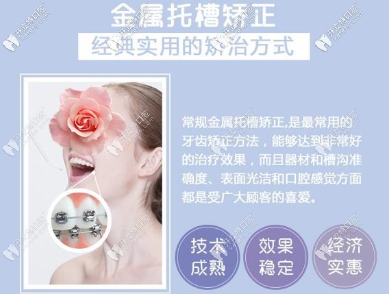 深圳微爾口腔金屬托槽牙齒矯正價(jià)格