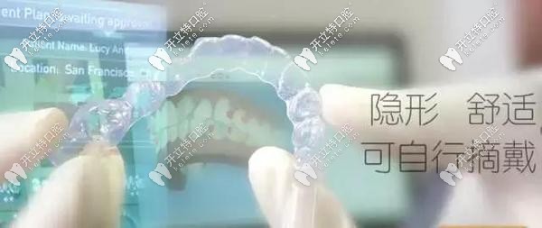 與傳統(tǒng)矯正相比隱形矯正有哪些優(yōu)勢？
