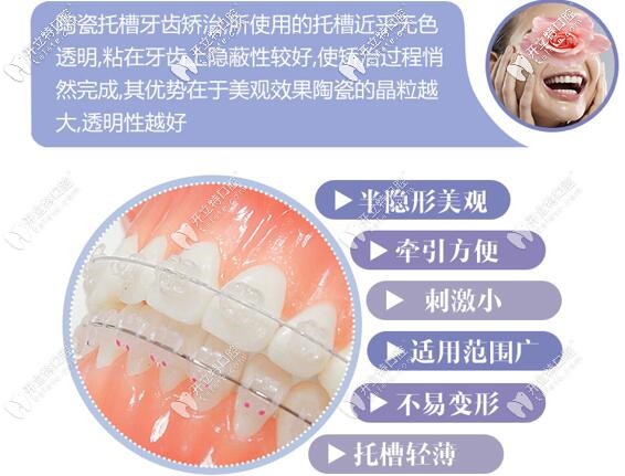 深圳微爾口腔美國3M陶瓷半隱形牙齒矯正價(jià)格
