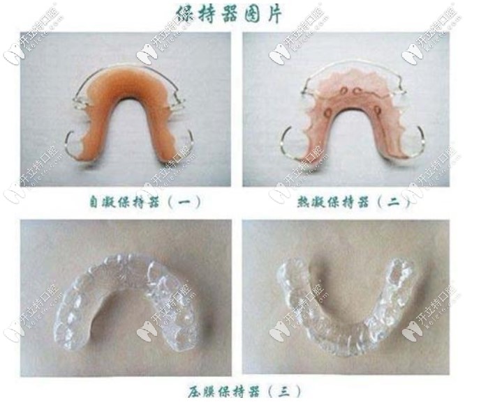 網(wǎng)上找的保持器圖片，我戴的是透明的保持器