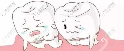 牙列不齊要盡快矯正