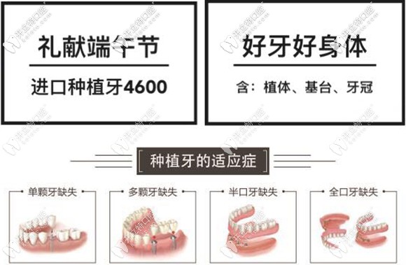 在太原做半口半固定種植牙只需27600元起,這價格值得了解哦!