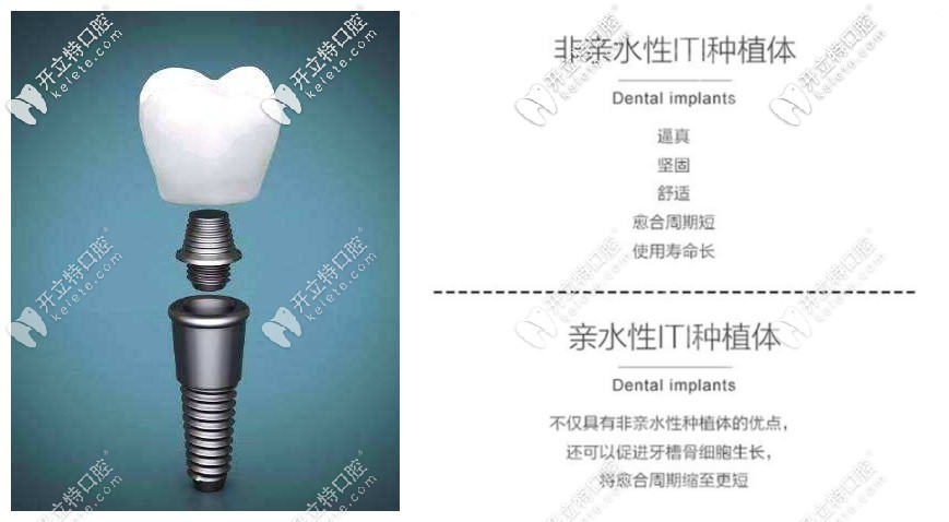 瑞士ITI親水性和非親水性優(yōu)勢圖