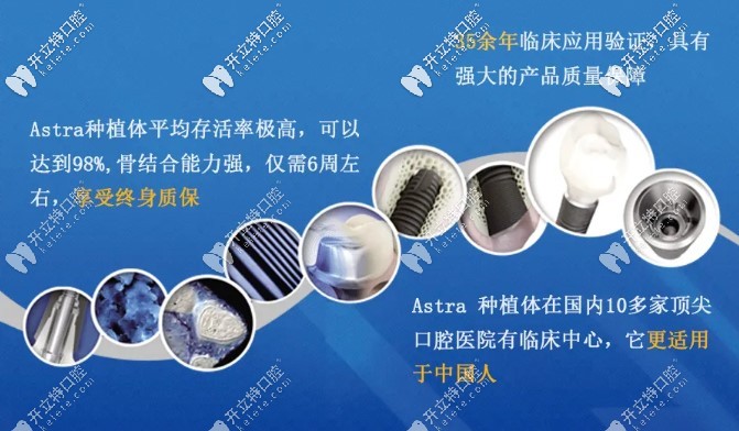 長沙利爾口腔瑞士Astra種植牙優(yōu)勢(shì)