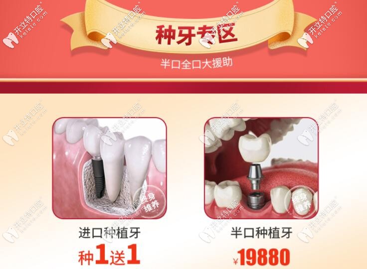 南寧柏樂口腔種植牙優(yōu)惠價(jià)格