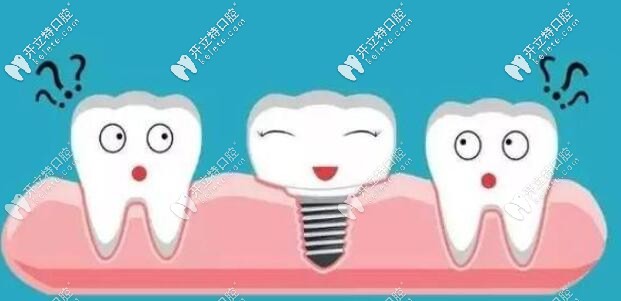 面診西安牙科發(fā)現(xiàn)歐美皓圣種植牙與韓國(guó)登騰價(jià)格區(qū)別不大