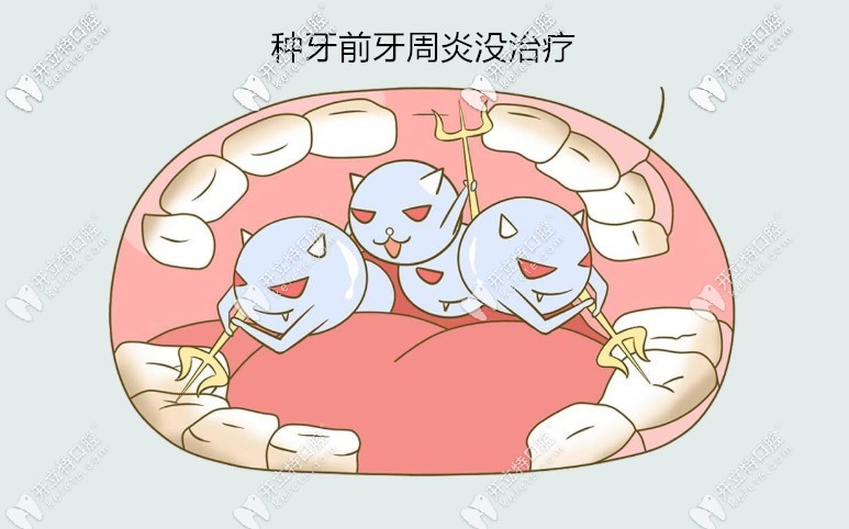 種牙后牙床全爛了是種植前牙周有炎癥沒有進行控制