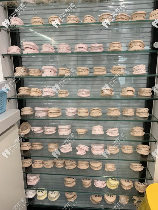 矯正時牙模的一角