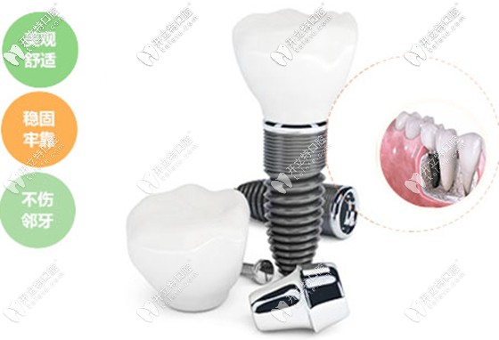 美國皓圣hiossen和韓國奧齒泰補(bǔ)貼價(jià)超優(yōu)惠