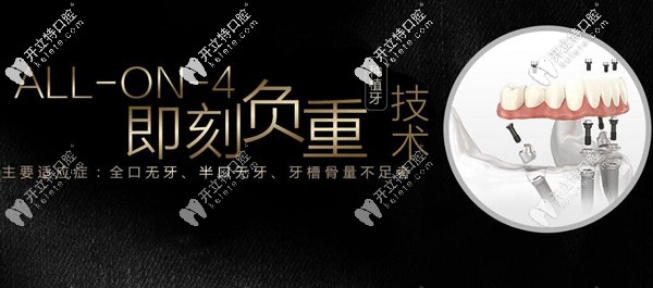 福州allon4即刻負(fù)重種植牙多少錢