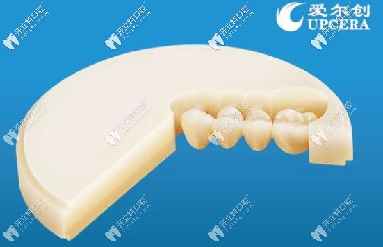 愛(ài)爾創(chuàng)全瓷牙